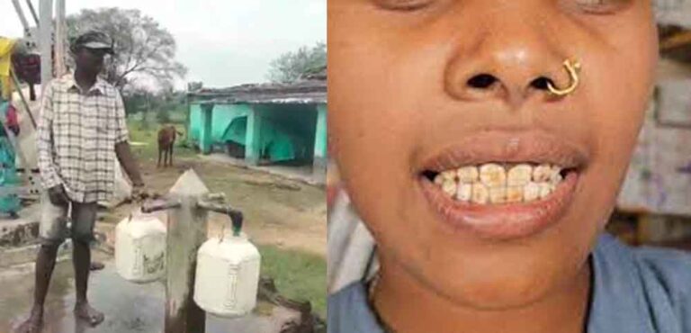 छत्तीसगढ़-गरियाबंद में फ्लोराइड युक्त पानी पर मांगा जवाब, हाईकोर्ट ने पीएचई विभाग से मांगा शपथ पत्र