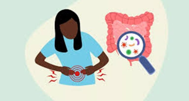 आरा में जलेबी से फूड पॉइजनिंग का मामला, 50 से अधिक बीमार, जांच में जुटी टीम