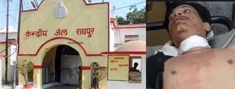 रायपुर सेन्ट्रल जेल के बाहर चली गोली, एक युवक गंभीर