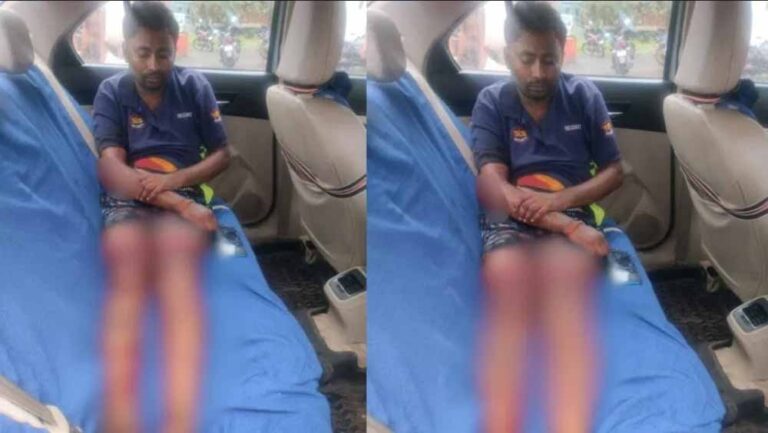 चॉइस सेंटर संचालक पर जानलेवा हमला, पुरानी रंजिश बनी वजह