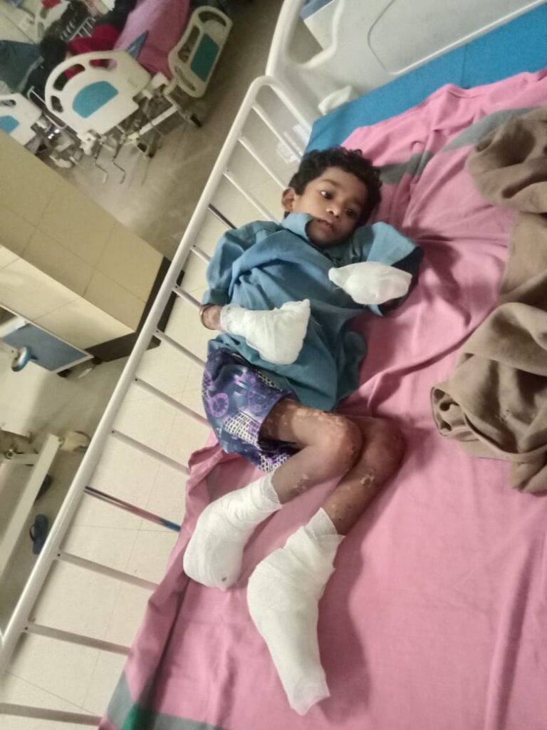 अबूझमाड़ के जंगल से निकालकर बीमार बचपन को जिला प्रशासन ने नई जिंदगी के लिए पहुंचाया रायपुर….